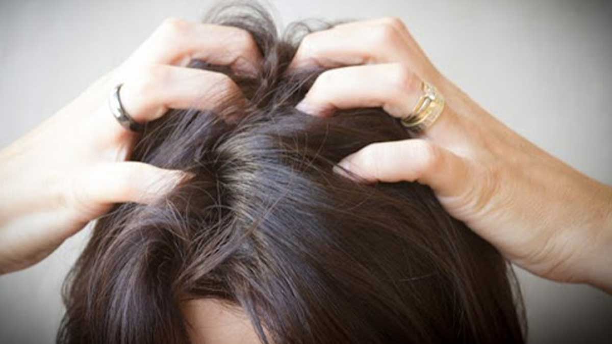 تفاوت قارچ مو و پسوریازیس پوست سر چیست؟